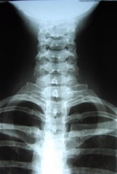 X-Ray in Spanish Fork | Adam Idsinga - Chiropractor in Spanish Fork